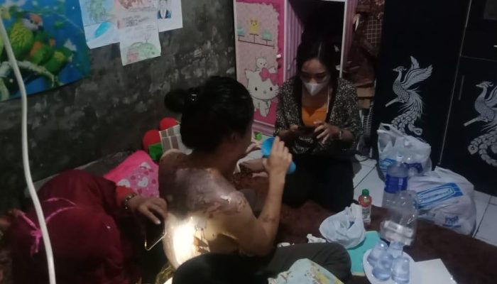 Usai Mandi, Seorang Transgender di Cilegon Disiram Minyak Panas. Seluruh Badan Nyaris Melepuh