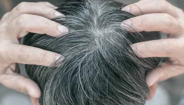 Tips Menghitamkan Uban Yang Perlu Dicoba, Ternyata Bahan Bakunya Sangat Mudah Didapat