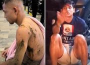 Pemain Timnas Malaysia Diserang Orang Tak Dikenal, Terbaru Disiram Air Keras